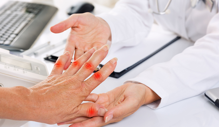 7 Important Tips to Treat Rheumatoid Arthritis