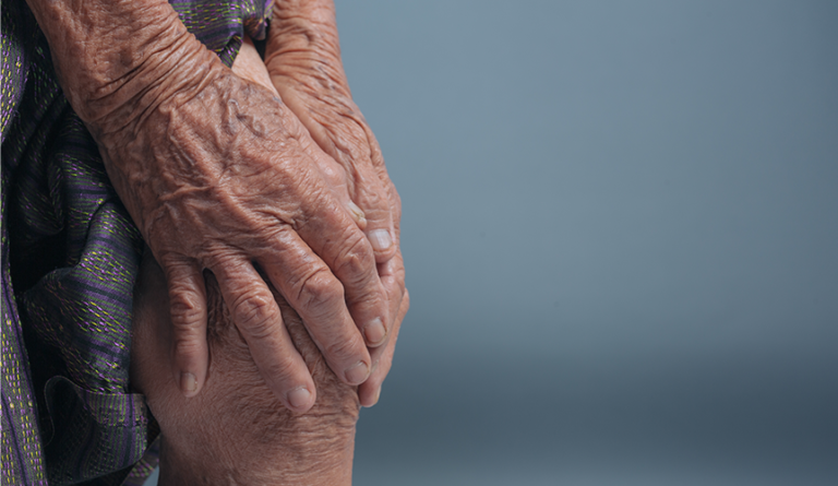 Is Rheumatoid Arthritis Genetically Passed Disease?