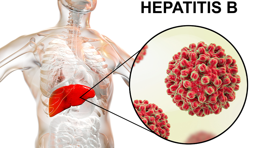 various states of Hepatitis B