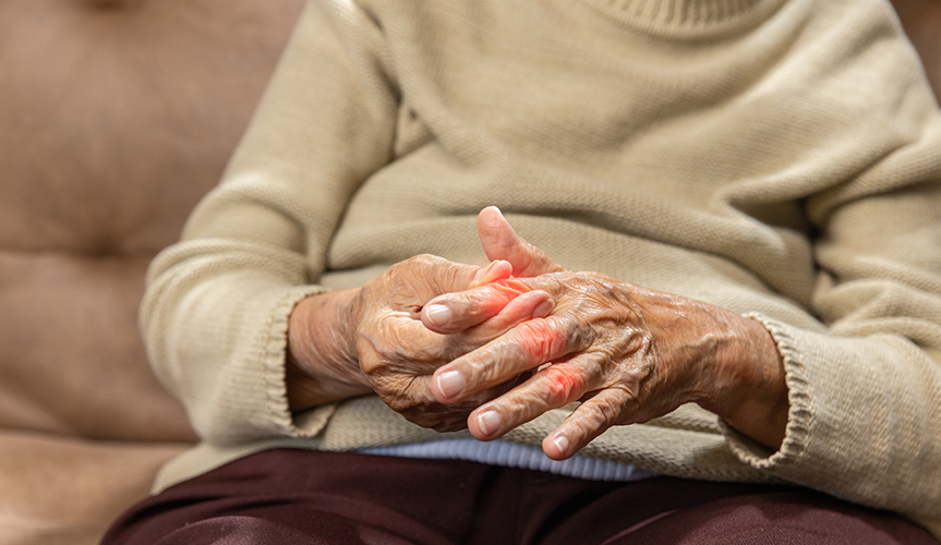 7 Best Suggested Medicines to treat Arthritis