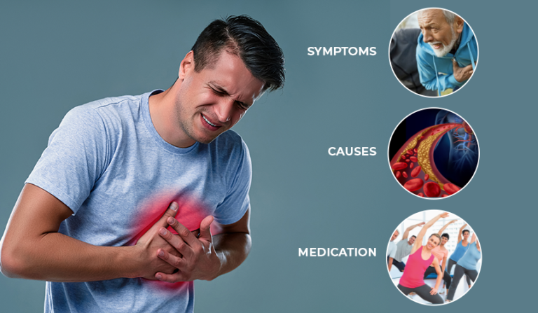 Heart Failure – Symptoms, Causes, and Medication