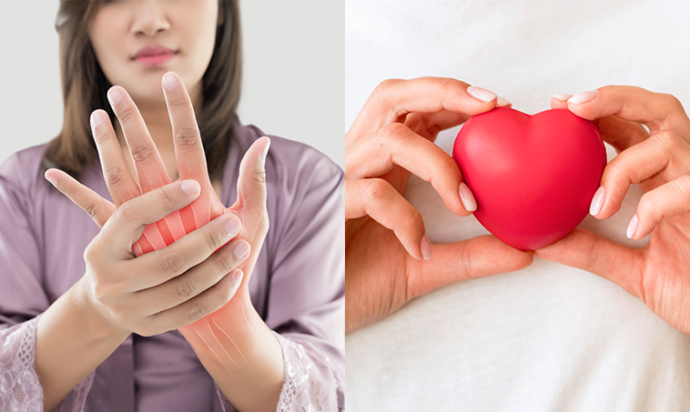 Rheumatoid Arthritis and Heart Health: Things You Need to Know