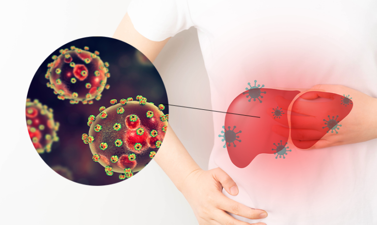 Viral Hepatitis: Everything You Need to Know