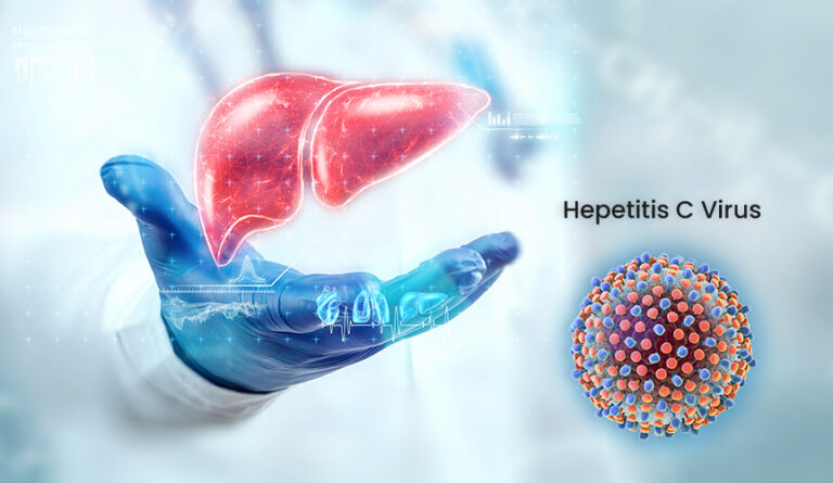 Hepatitis C: Symptoms, Causes, and Treatment