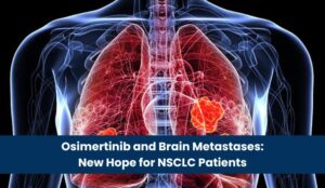 Osimertinib and Brain Metastases_ New Hope for NSCLC Patients