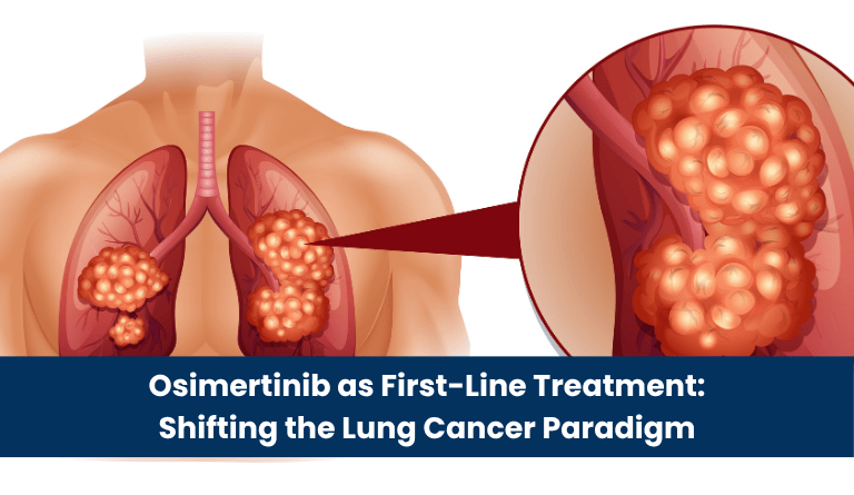 Osimertinib as First-Line Treatment Shifting the Lung Cancer Paradigm