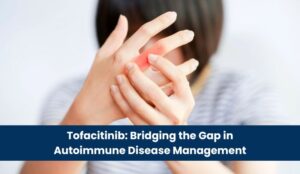 Tofacitinib_ Bridging the Gap in Autoimmune Disease Management
