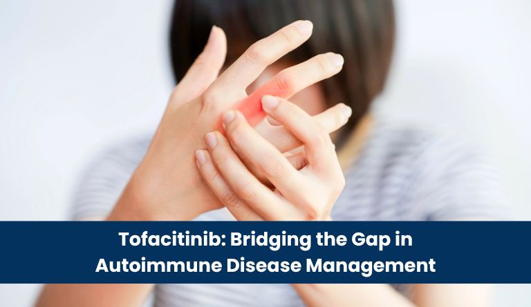 Tofacitinib_ Bridging the Gap in Autoimmune Disease Management
